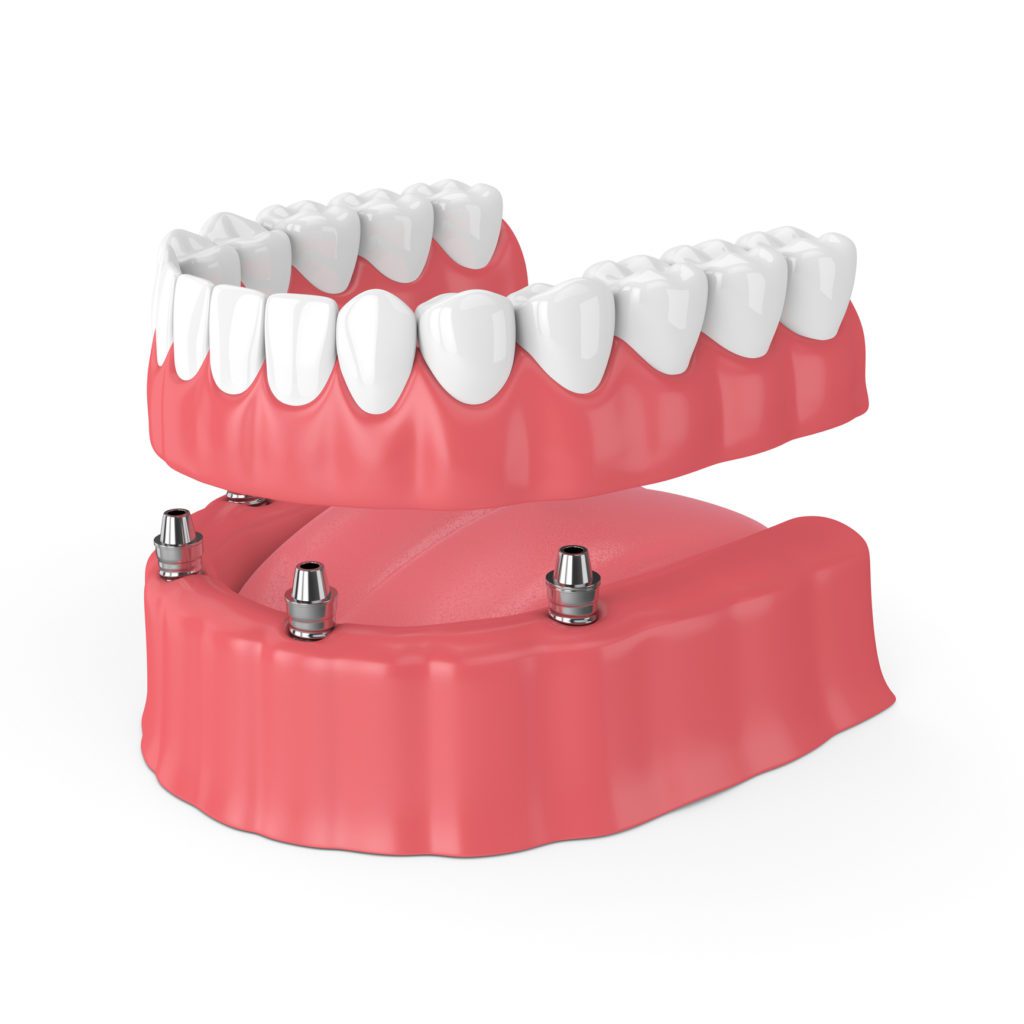 Full and Partial Dentures in Midland, Texas