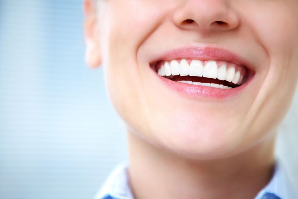 dental bonding treatment Midland Texas