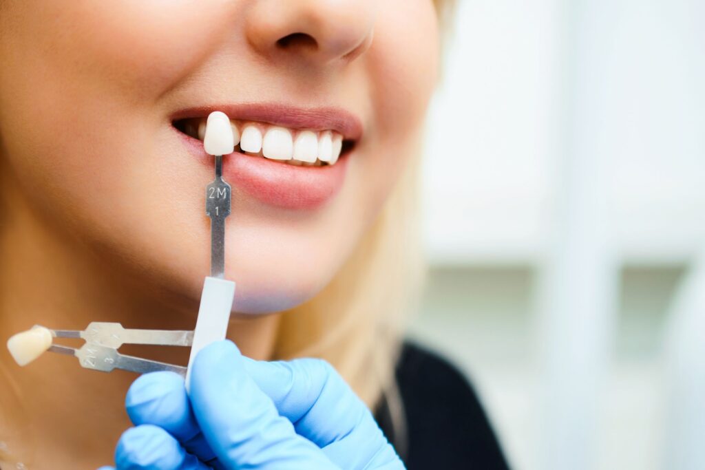 porcelain veneers oral health benefits