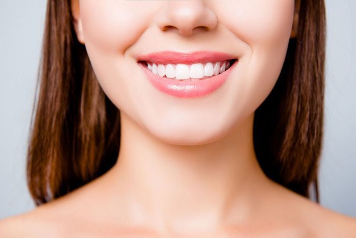 Smile Enhancement with Bonding or Veneers